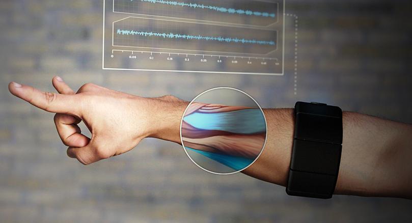 Thalmic Myo: Dette armbåndet lytter til musklene dine.Foto: Thalmic Labs