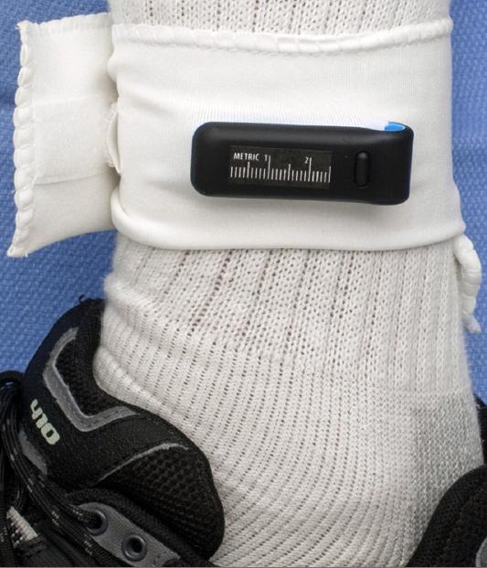 149 pasienter fikk festet en Fitbit på ankelen. 
Foto: Mayo Clinic.