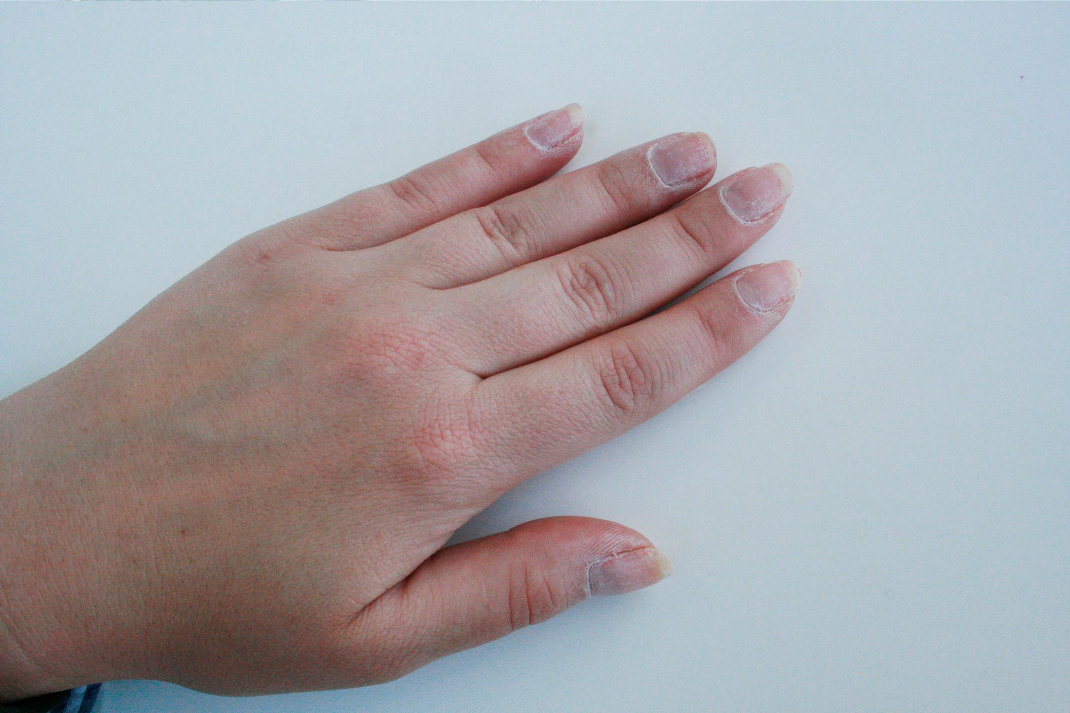 STEG 9: Både negler og neglebånd kan kjennes tørre ut etter å ha vært dynket i aceton. Smør hendene godt med en olje eller fet håndkrem.